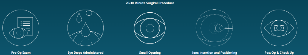 diagram of what to expect during your procedure